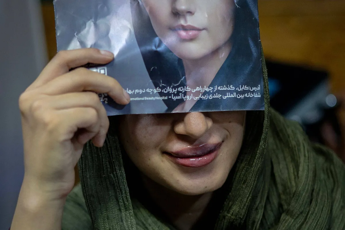 عمليات التجميل تلقى رواجاً في كابل رغم قيود «طالبان» الصارمة