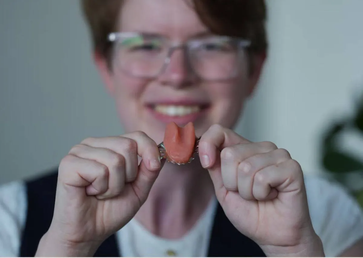 NHS provides first custom artificial tongue to cancer survivor in Britain
