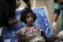 A Palestinian child wounded during the Israeli bombardment of the Gaza Strip receives treatment at the Al-Aqsa Hospital in Deir al-Balah, Thursday, Dec. 19, 2024. (AP Photo/Abdel Kareem Hana)