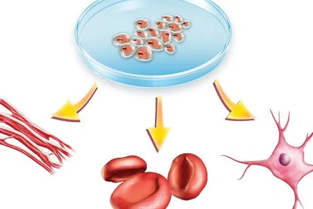 العلاج بالخلايا الجذعية.. بين التجارة والحقيقة العلمية