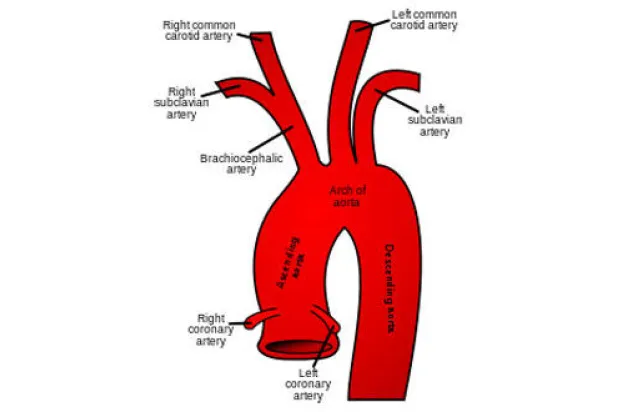 تضيق الشريان السباتي.. التشخيص والعلاج