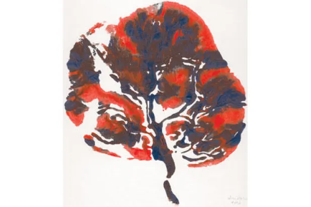 المشيمة.. «شجرة حياة الطفل الوليد»