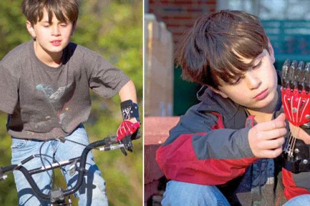 أيادٍ وأطراف صناعية من طابعات ثلاثية الأبعاد