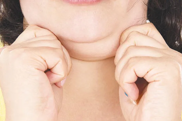 الحقن خيارًا جديدًا لعلاج اللغد من دون جراحة