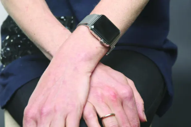 لماذا قررت التخلي عن ساعة «آبل»؟