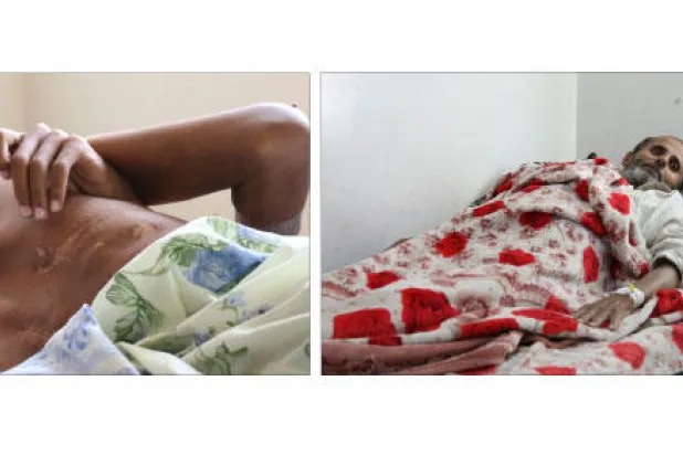 الإصابات في أجساد الجرحى توثق جرائم ميليشيات الانقلاب