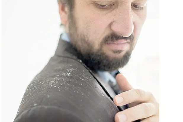 قشرة الرأس... ما أفضل الوسائل لعلاج حالاتها الشديدة؟