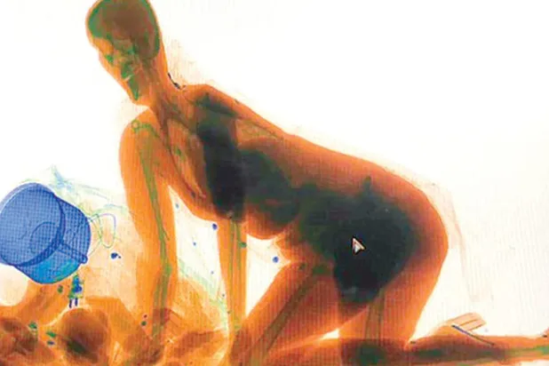 صينية تدخل في جهاز الأشعة لتفادي سرقة حقيبتها