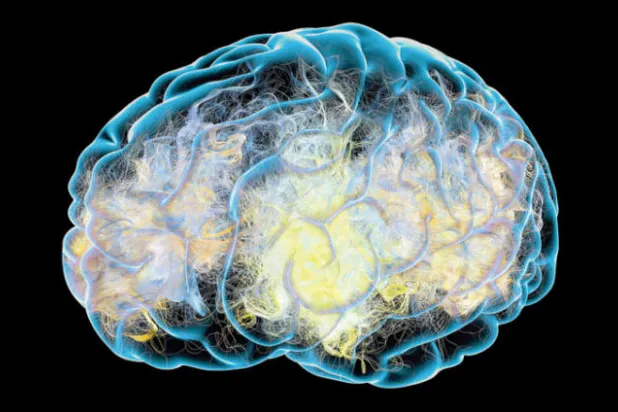 «الازدحام المروري» لإشارات الدماغ يتسبب بمرض باركنسون