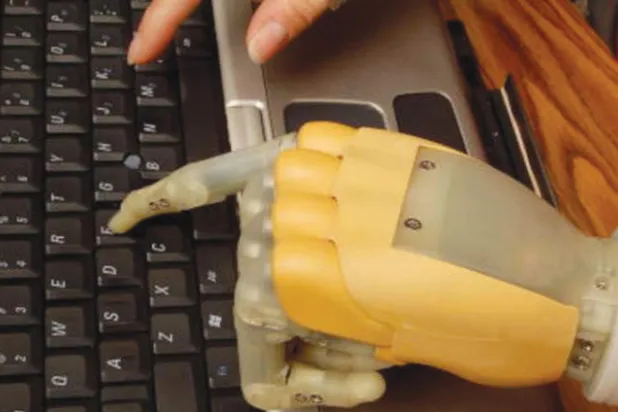 تطوير ذراع آلية تدار عبر التفكير