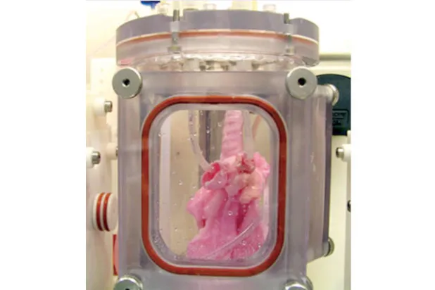 عملية ناجحة لزراعة رئة مهندَسة بيولوجياً داخل مختبر