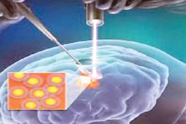 جهاز «جي بي إس للجسم» يرصد أماكن الأورام الخبيثة