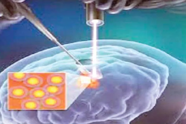 جهاز يرصد أماكن الأورام الخبيثة