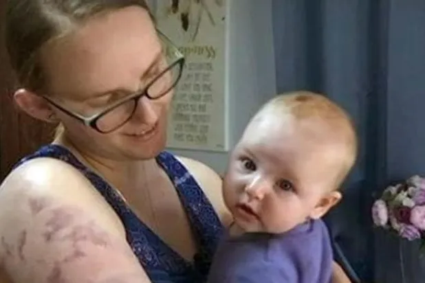 أم أسترالية حمت بجسدها رضيعتها وجدّتَها من عاصفة عنيفة