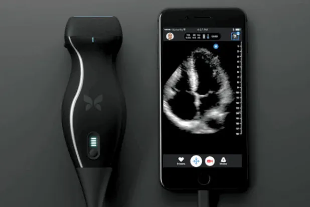 «بترفلاي»... جهاز مطور صغير للأشعة فوق الصوتية