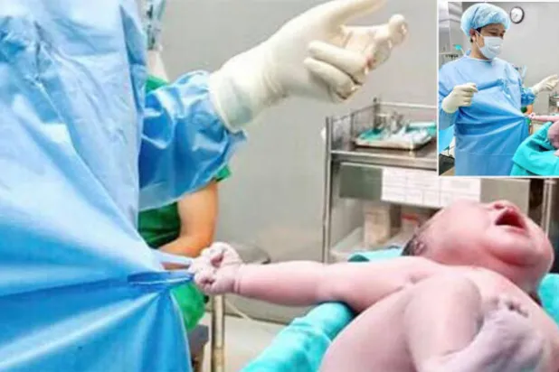 صورة مذهلة لرضيع بعد ولادته يمسك بملابس الطبيب