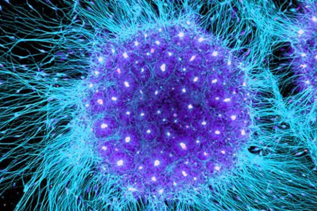 علاج «الخلايا الجذعية» يهزم الإيدز للمرة الثانية