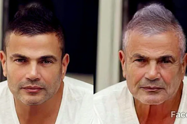 الفنان عمرو دياب بعد تعديل صورته