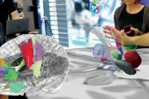 أول خريطة لمسارات حيوية بالدماغ بتقنية الهولغرام