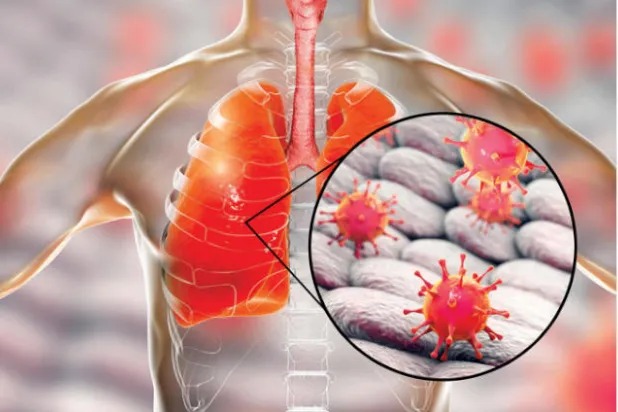 فيروس جديد غامض يهدد باجتياح العالم