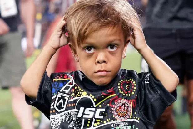 فتى تعرّض للتنمّر بسبب القزامة يتبرع بـ475 ألف دولار لجمعيات خيرية