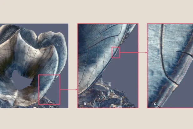 الأسنان تروي تفاصيل حياة الأشخاص بعد الموت