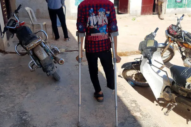 فتيان من دون أرجل يعملون في مهن شاقة بانتظار «أطراف صناعية»