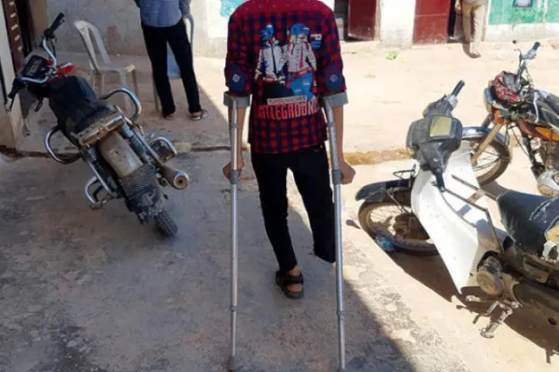 Suriye savaşından geriye kalan dram: Uzuvlarını kaybeden 86 bin çocuktan bazıları protez beklerken çalışmak zorunda