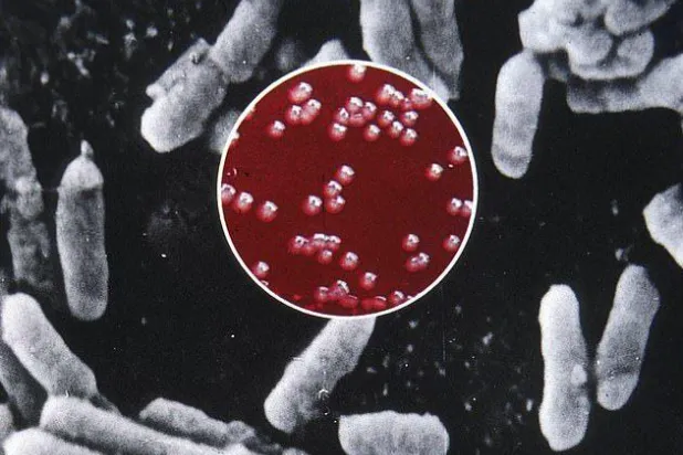 أميركا تسجل أول وفاة بالطاعون هذا العام لشاب عشريني