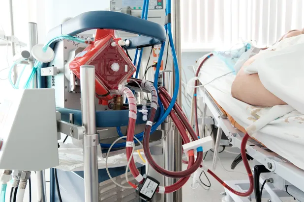 Saudi Arabia is using ECMO Technology to Treat COVID-19 Patients