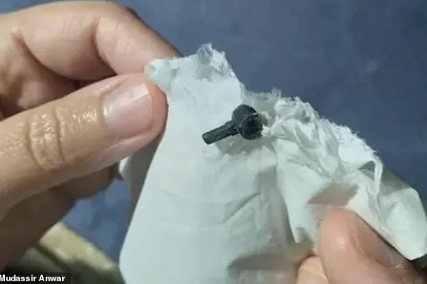 قطعة ليغو تخرج من أنف طفل بعد عامين من فقدانها