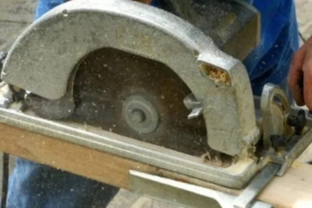 إدانة امرأة قطعت يدها عمداً للاحتيال على شركة تأمين