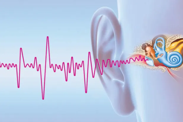 صدمات كهربائية على اللسان لعلاج طنين الأذن