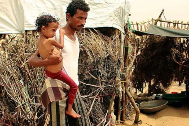 Savaş yüzünden evlerinden olan Yemenlilerin trajedisi