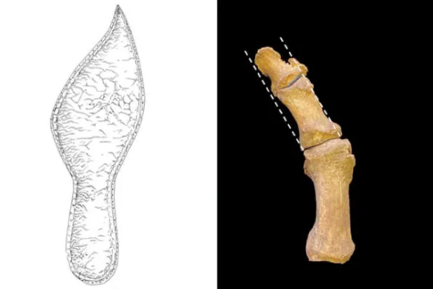 أزياء العصور الوسطى للأحذية المدببة مرتبطة بزيادة أورام القدم