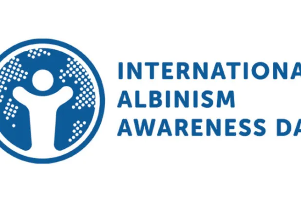 دعوات لوضع حد للتمييز ضد المصابين بـ«المهق»