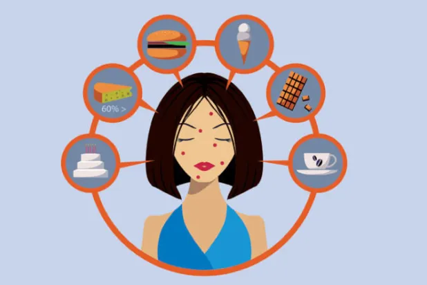 حبّ الشباب... وتأثيرات أنواع الأطعمة