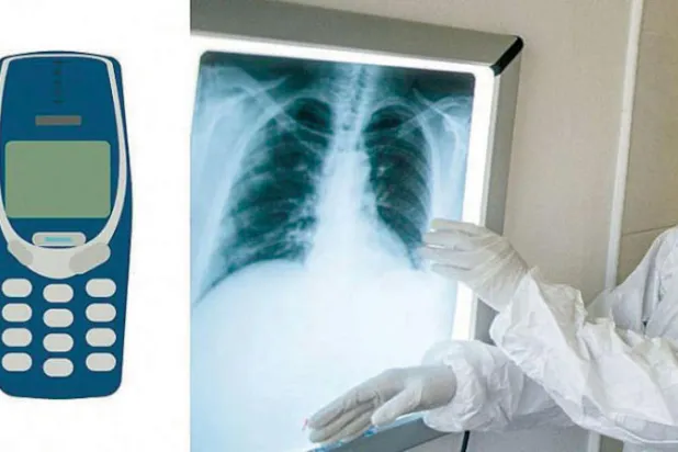 استخراج هاتف من معدة سجين في كوسوفو