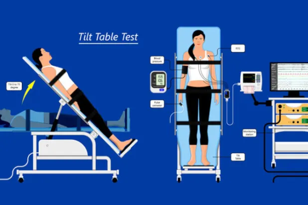 «متلازمة» غير عادية تدفع بالقلب للتسارع عند الوقوف