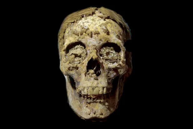 لسان ذهبي في فم مومياء مصرية