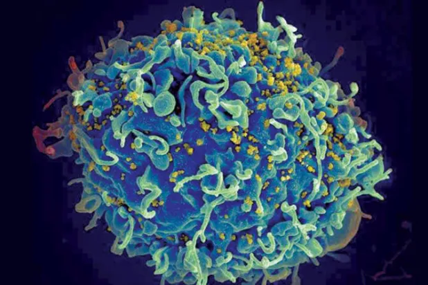 الأسرار المناعية لمرضى قضوا على الإيدز بلا دواء