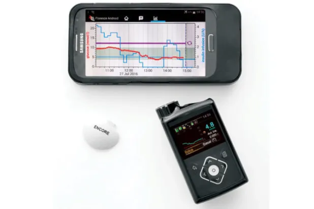 بنكرياس صناعي  يغير حياة أطفال السكري