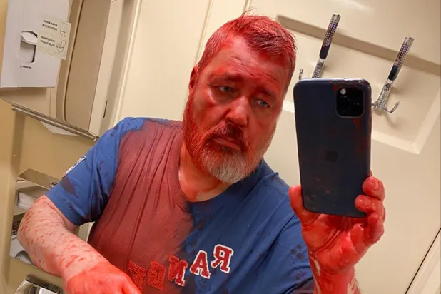 ABD, Dimitry Muratov'a düzenlenen saldırının arkasında Rus istihbaratını buldu