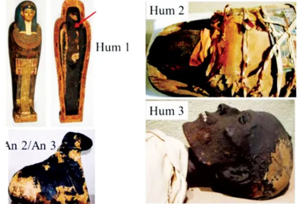 مومياوات أجريت عليها الدراسة (دورية التصوير بالرنين المغناطيسي)