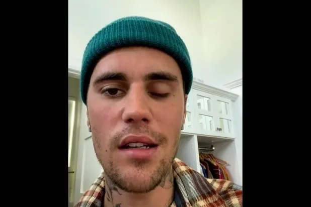 المغني الكندي الشهير جاستن بيبر وتبدو عليه علامات الإصابة بالمرض (إنستغرام)