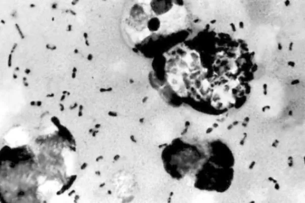 بكتيريا الطاعون «Yersinia pestis» (أ.ف.ب)