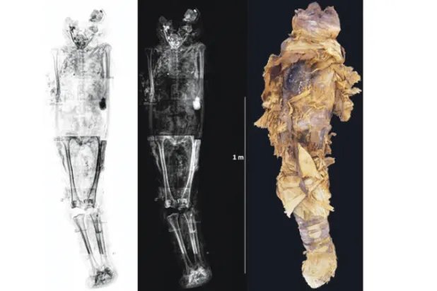 المومياء المصرية المصابة بالسكتة الدماغية (مجلة أوبن إيديشن)