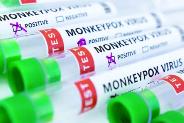 عينات إيجابية من فيروس جدري القردة في مختبر طبي (رويترز)