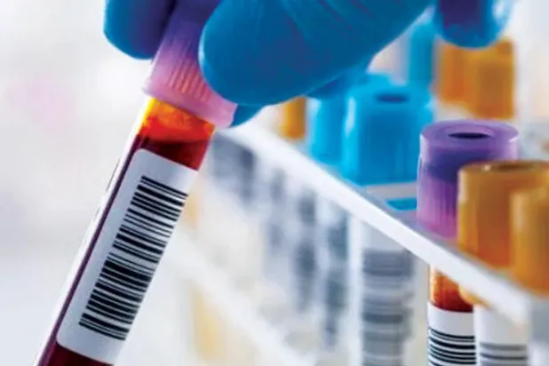 اختبار الدم المطور يلتقط إشارة السرطان مبكراً (غيتي)