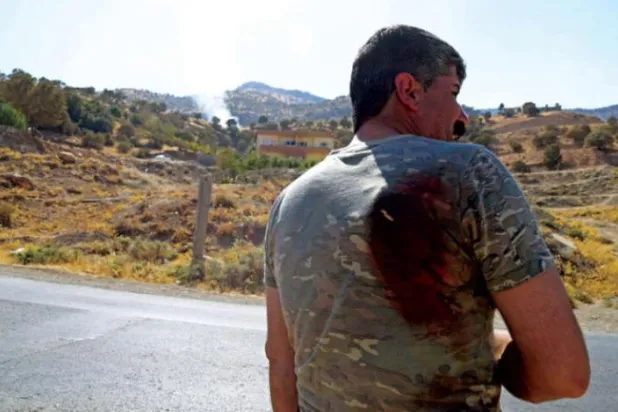 پرسوں ایرانی بمباری سے زخمی ہونے والا ایک کرد شخص (اے ایف پی)